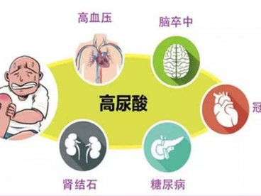 尿酸高能买重疾保险吗?什么时候买重疾险合适?