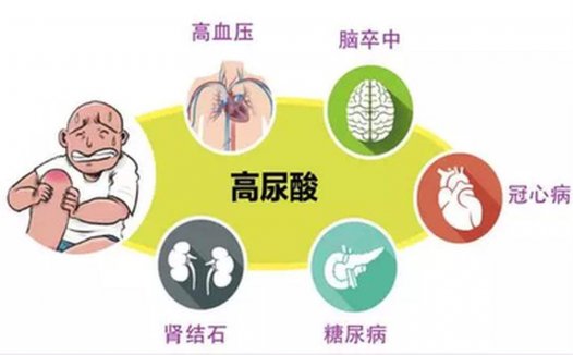 尿酸高能买重疾保险吗？什么时候买重疾险合适？